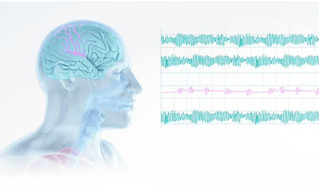 Guideline-compliant sedation even in difficult situations.