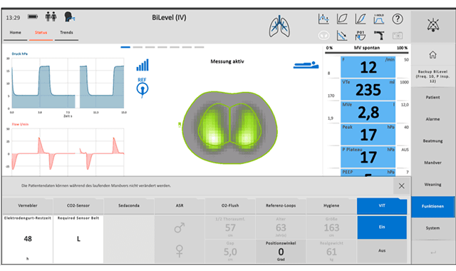 The imaging navigation system for intensive care ventilation. การวัดปริมาตรปอดด้วยความต่างศักย์ของไฟฟ้า